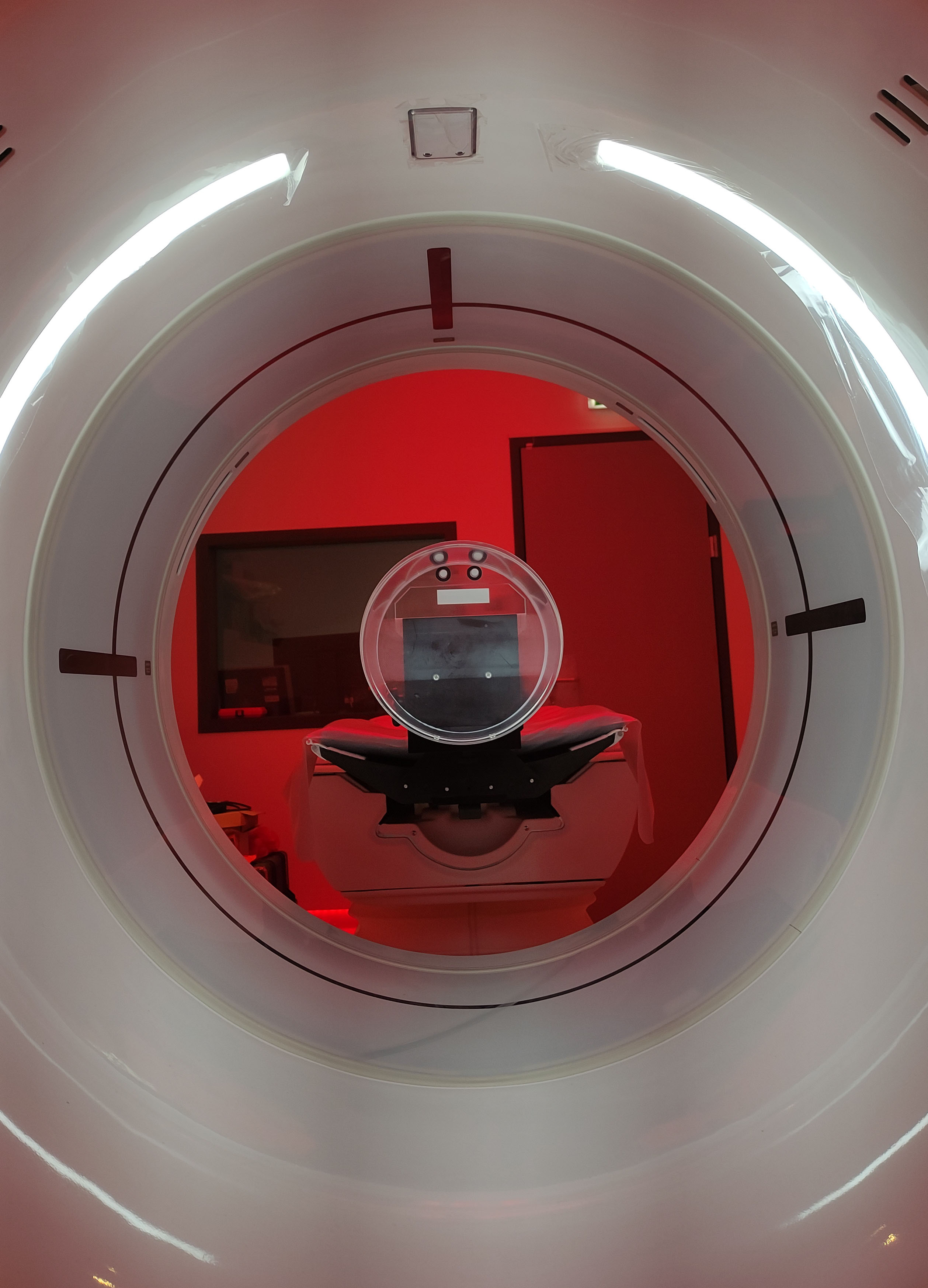 CT Scan Revolution